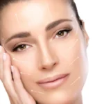 Aplicacion Botox
